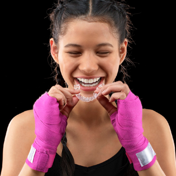 Sports And Aligners PhiAligner KnowledgeBase